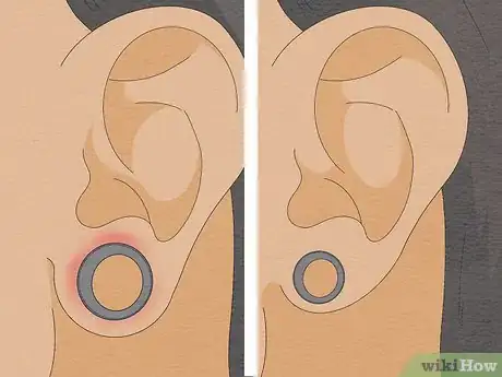 Image titled Stretch Your Ears Pain Free Step 10