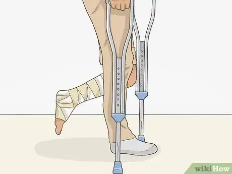 Image titled Go Upstairs with Crutches Step 1