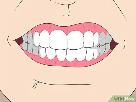 Image titled Wear Dentures Step 4