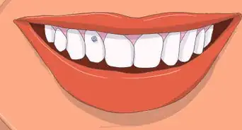 Apply Tooth Gems