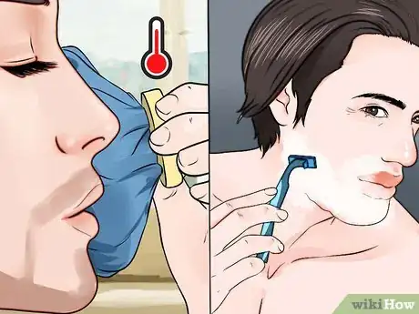 Image titled Remove Ingrown Hair on Your Face Step 11