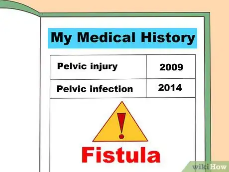 Image titled Diagnose a Fistula Step 16