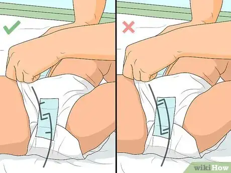 Image titled Relieve Diaper Rash Fast Step 19