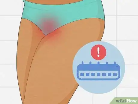 Image titled Diagnose a Yeast Infection at Home Step 17