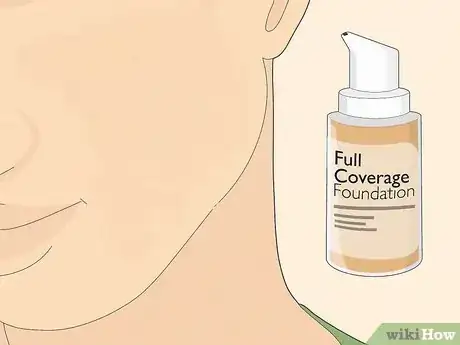 Image titled Get Rid of Cystic Acne Scars Step 18