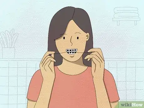 Image titled Make Out With Braces Step 13