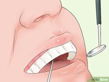 Image titled Get Healthy Gums Step 6