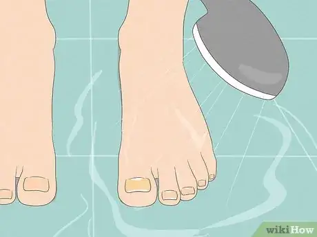 Image titled Remove a Dead Toenail Step 7