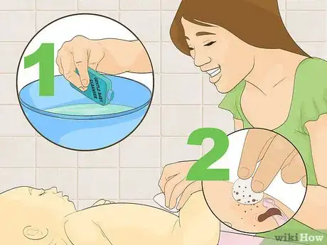 Image titled Clean a Baby's Belly Button Step 4