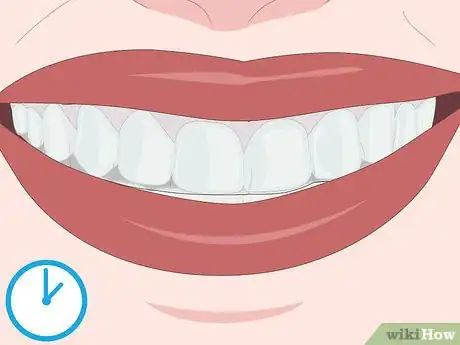 Image titled Protect Gums During Teeth Whitening Step 8