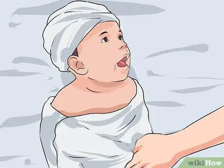 Image titled Prevent Cradle Cap Step 13