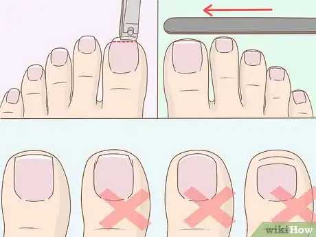 Image titled Get Healthy, Clean and Good Looking Feet Step 5