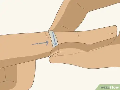 Image titled Remove a Ring in an Emergency Step 6