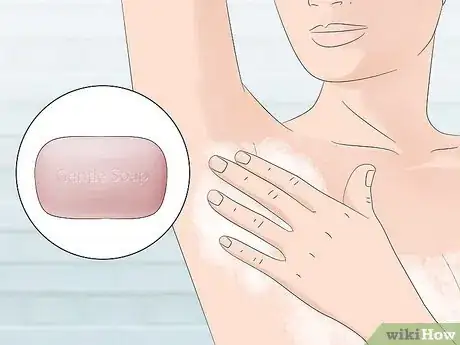 Image titled Stop Armpit Pimples Step 1