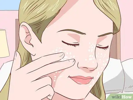 Image titled Get Rid of Acne Without Using Medication Step 14