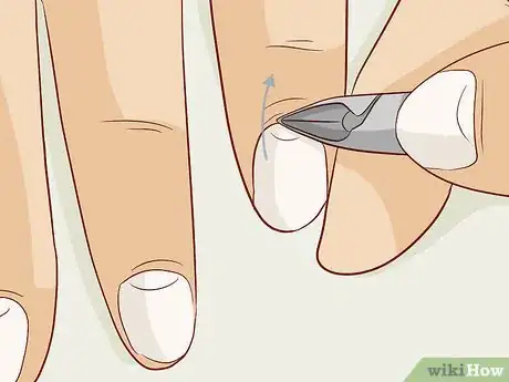 Image titled Care for Your Nails Step 8