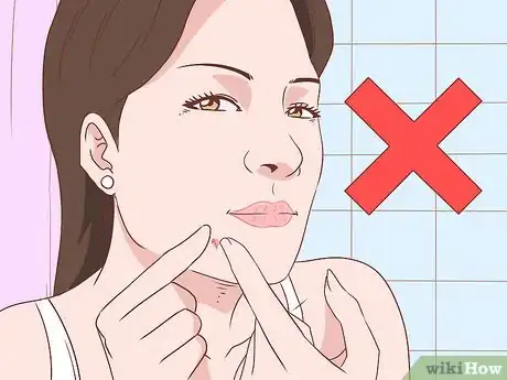 Image titled Get Rid of Acne Without Using Medication Step 30