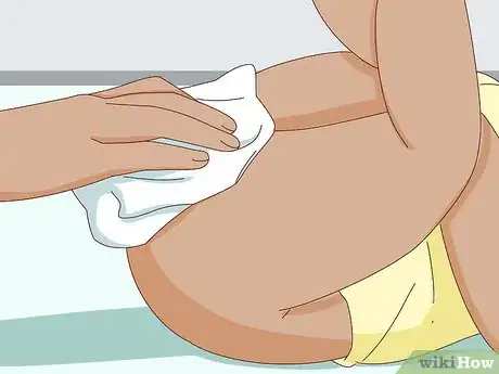 Image titled Change a Disposable Bedwetting Diaper Step 8