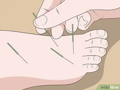 Image titled Cure Arthritis in Feet Naturally Step 23