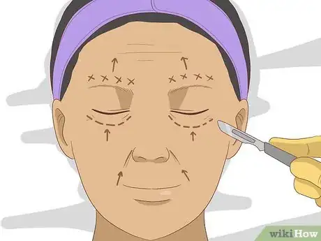 Image titled Remove Deep Facial Wrinkles Step 15