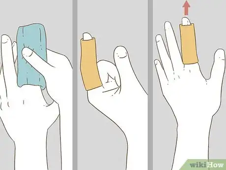 Image titled Determine if a Finger Is Broken Step 8