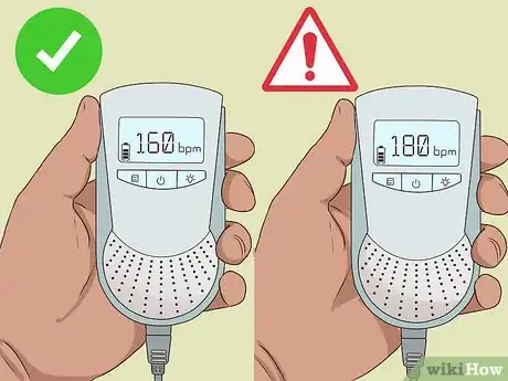 Image titled Monitor Fetal Heart Rate Step 12