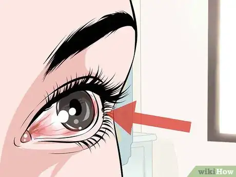 Image titled Choose Contact Lenses Step 15