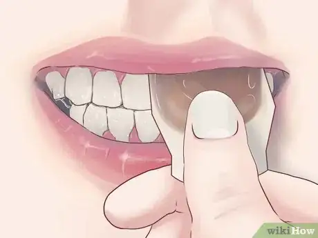 Image titled Treat Gum Disease With Home Made Remedies Step 3