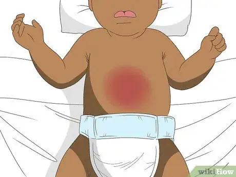 Image titled Tell if Your Newborn Has Diarrhea Step 6