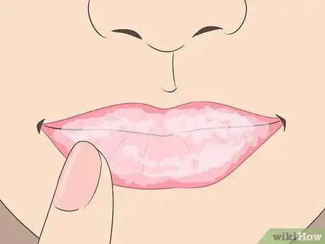 Image titled Make Lips Look Bigger Step 3