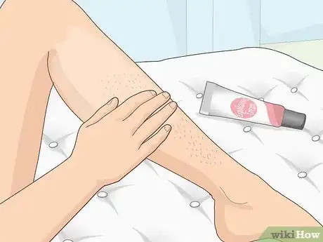 Image titled Stop Legs from Itching Step 2