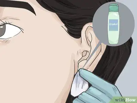 Image titled Pierce Your Ear with a Safety Pin Step 4