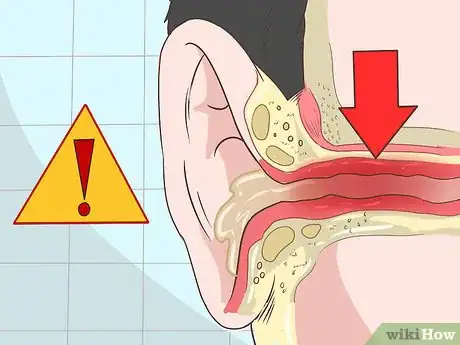 Image titled Get Rid of Ear Wax Step 1