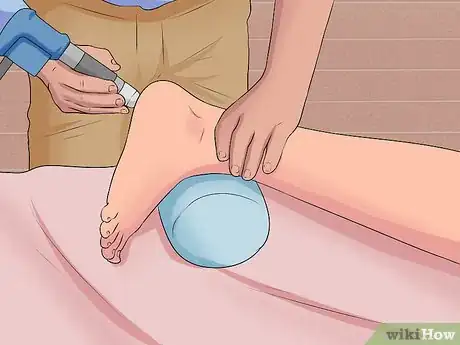 Image titled Treat Plantar Fasciitis Step 10