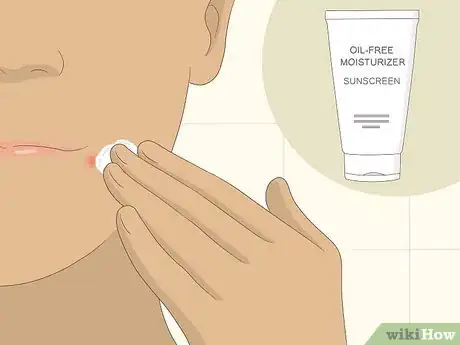 Image titled Get Rid of Acne Redness Fast Step 11