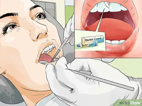 Image titled Reverse Tooth Decay Step 4