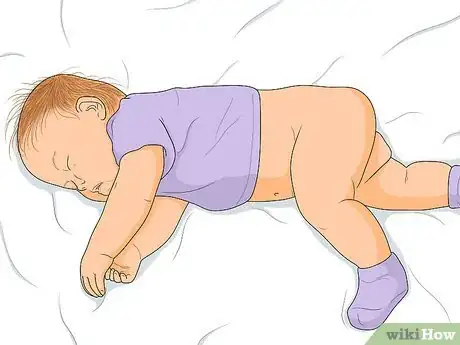 Image titled Relieve Diaper Rash Fast Step 18