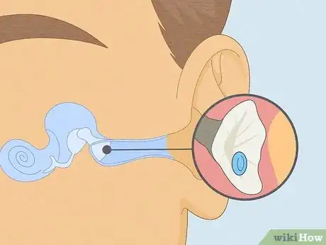 Image titled Drain Ear Fluid Step 15