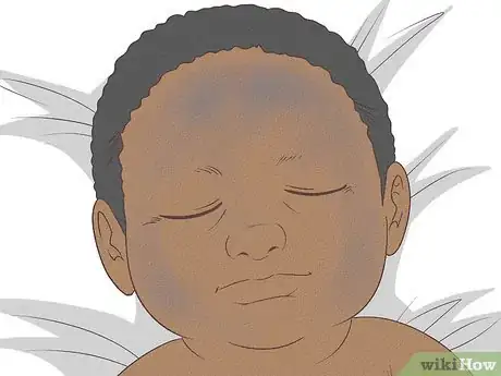 Image titled Know What to Expect on a Newborn's Skin Step 20