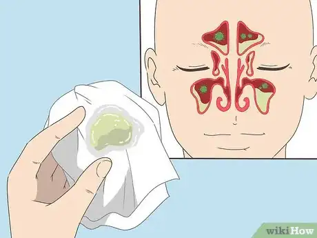 Image titled Get Rid of Mucus Step 2