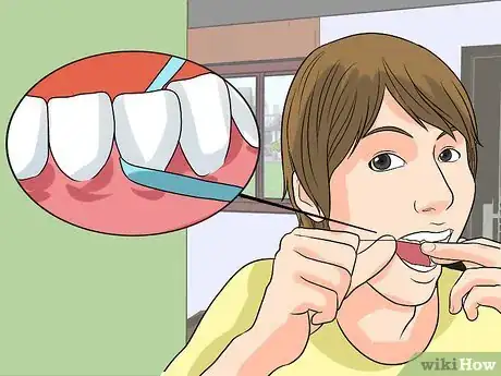 Image titled Soothe Red and Inflamed Gums Step 17