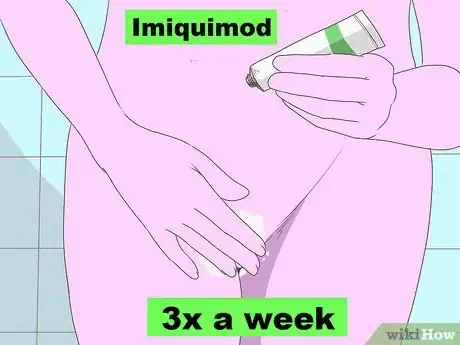 Image titled Get Rid of Genital Warts Step 5