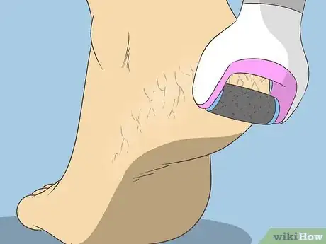 Image titled Get Rid of Dry Skin on Feet Step 6