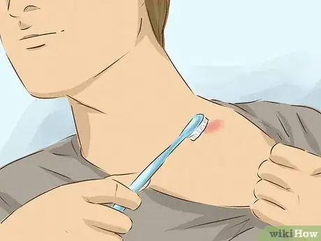 Image titled Hide a Hickey Step 8