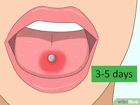 Image titled Reduce Tongue Swelling Step 9