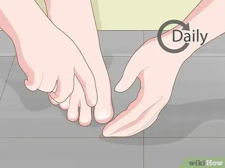 Image titled Prevent Ingrown Nails Step 8