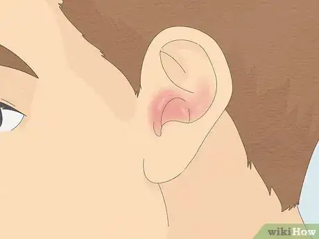 Image titled Remove a Bug from Your Ear Step 13