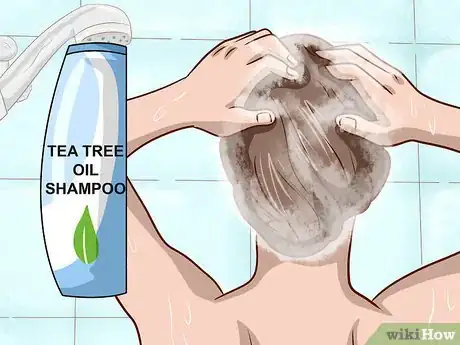 Image titled Stop Scalp Picking Step 10