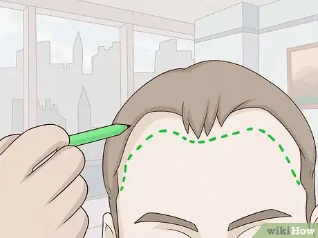 Image titled Regrow Hair Naturally Step 20