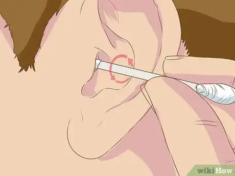 Image titled Use Ear Candles Step 15